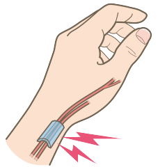 tendon-sheath-inflammation