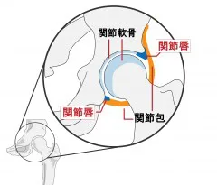 股関節の痛み 変形性股関節症 健やか整骨院